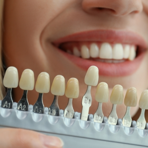 Affordable Dental Services in Meerut