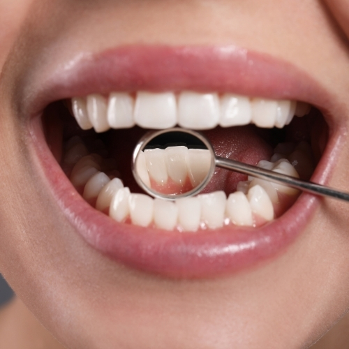 Best Dentist In Meerut